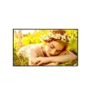 LG VIS LG 24/7 Signage kijelző 75" 75UL5Q, 3840x2160, 500cd/m2, HDMIx3/RS-232C/RJ45/USBx2